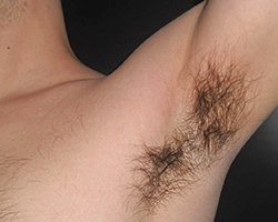 A young man lifting up his arm and showing his underarm hair