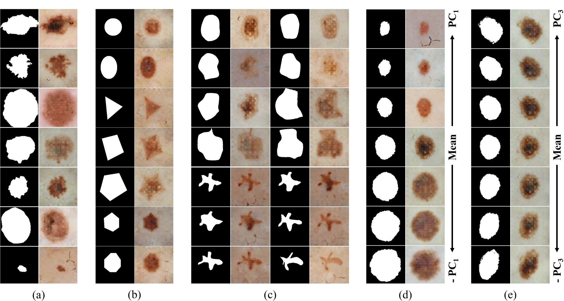 Mask2Lesion_Outputs