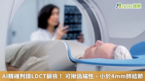 AI精確判讀LDCT篩檢！ 可揪偽陽性、小於4mm肺結節