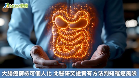 大腸癌篩檢可個人化 北醫研究證實有方法判知罹癌風險