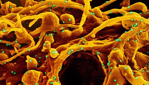 Colorized scanning electron micrograph of a cell (orange) infected with UK B.1.1.7 variant SARS-CoV-2 virus particles (green)