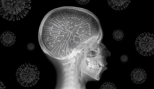 Image of a skull X-ray. The brain appears to be 