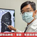 因失眠就醫卻檢出肺癌！ 醫籲：有家族史者應定期篩檢