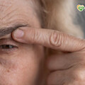 眼睛閉合不全害眼角膜潰瘍 她在「眼瞼內埋黃金」改善多年乾眼症