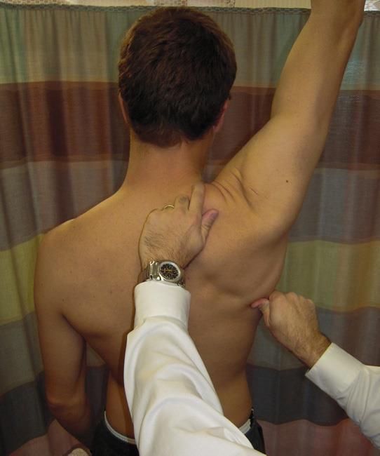 scapular assistance test