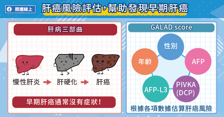 GALAD score肝癌風險評估，幫助發現早期肝癌