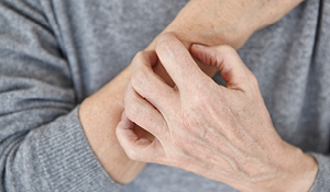 patient's hands