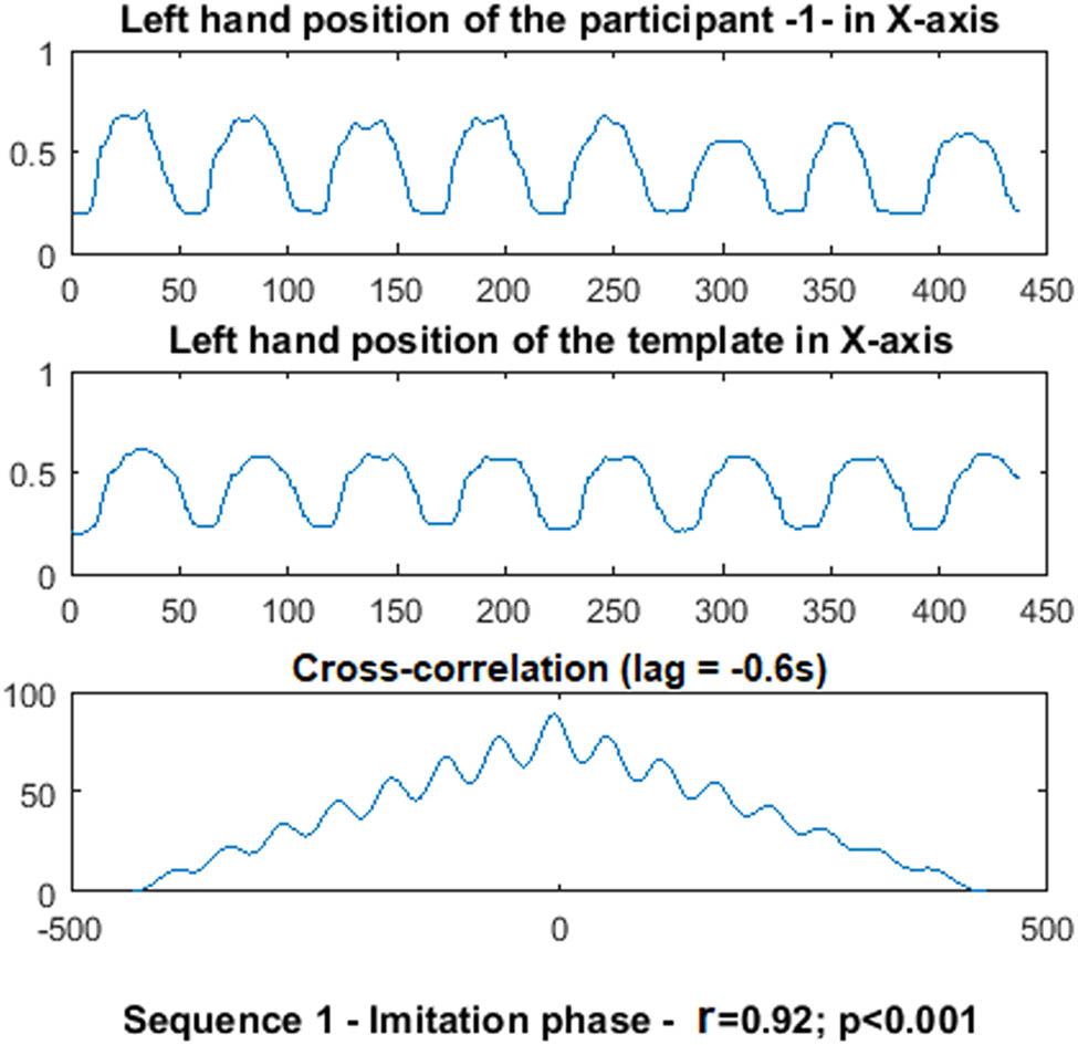 Figure 5 
                        The template’s (top) and participant’s (middle) hand positions in the X axis during the imitation phase of the first sequence with the virtual robot. The cross correlation between the two signals is computed (bottom) and the lag between the two signals is corrected to compute the correlation coefficient (r) between the two signals. The correlation coefficient is taken as an indicator of good performance.
                     