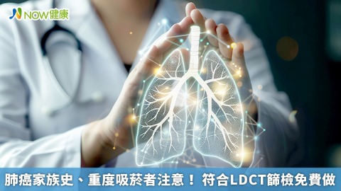 肺癌家族史、重度吸菸者注意！ 符合LDCT篩檢免費做