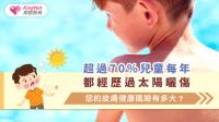 超過70%兒童每年都經歷過太陽曬傷，您的皮膚健康風險有多大？