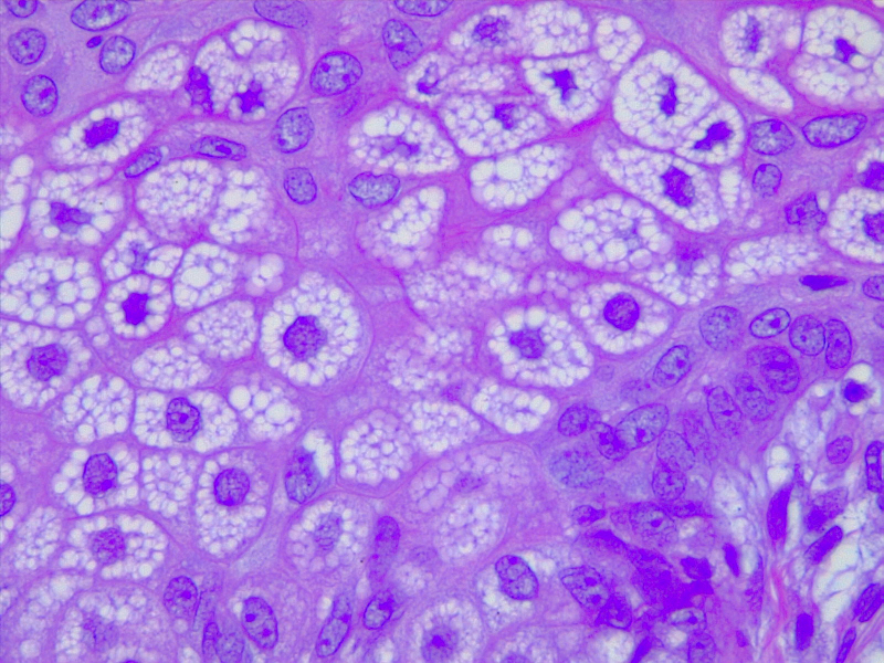 Sebocytes, Sebaceous Gland Cells