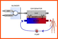 An illustration of how ECMO works