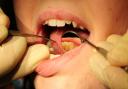 One in eight people in Sussex do not have a dentist.