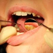 One in eight people in Sussex do not have a dentist.