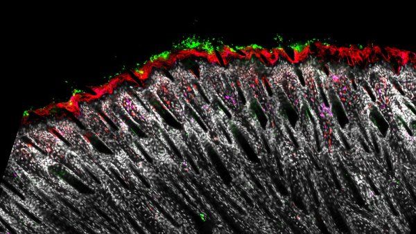 Microscopic image of skin bacteria and immune cells