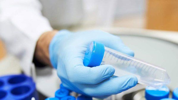 A hand wearing a light blue latex glove holds a testing tube with a blue cap over a group of other testing tubes in a lab.