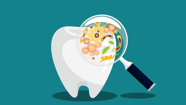 A graphic illustration of a magnifying glass looking closely at microbes on a tooth.