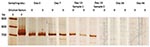 Thumbnail of Polyacrylamide gel electrophoresis (SDS-PAGE) analysis of broad range 16S rRNA gene PCR products obtained from blood samples. Lane 1, marker, 100 bp DNA ladder (Roche DNA Marker XIV); lane 2, positive control, Escherichia coli; following lanes, PCR products obtained from blood specimens arranged by date of collection. For each specimen PCR products are shown obtained with undiluted (0) and 5×-diluted (5) DNA extracts. The 2 last negative samples are not shown.