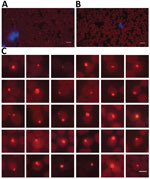 Anaplasma capra in the erythrocytes of an infected goat detected by fluorescence in situ hybridization (FISH) in study of emerging intraerythrocytic A. capra and high prevalence in goats, China. Glowing red indicates A. capra; blue indicates leukocyte nucleus stained with fluorescent antibody blocker containing DAPI. A) FISH results under fluorescence microscope of A. capra. B) FISH results of A. capra–negative blood smear. C) FISH results showing different shapes and sizes of A. capra in erythrocytes.