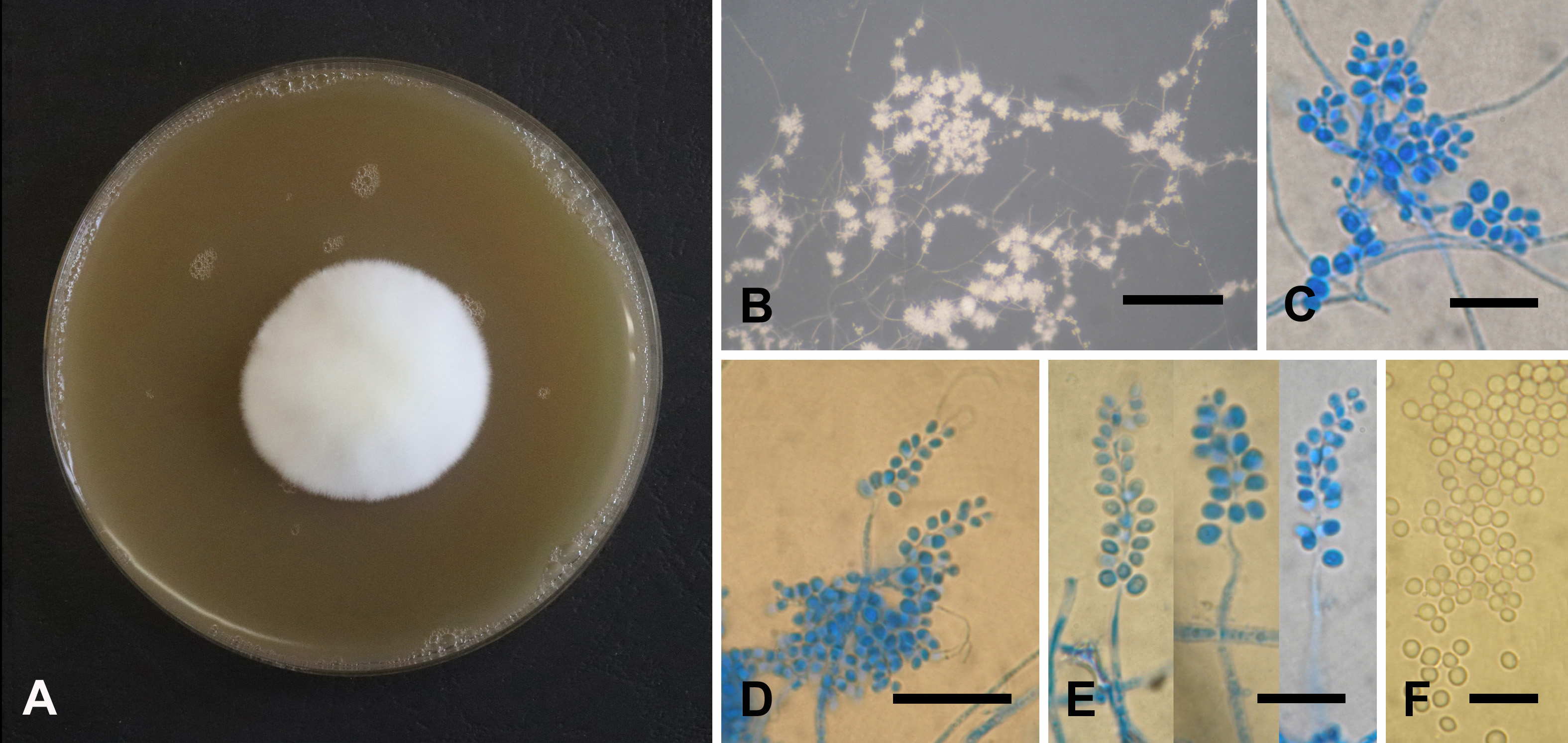 Fungi associated with ambrosia beetle Xylosandrus germanus in Slovakia