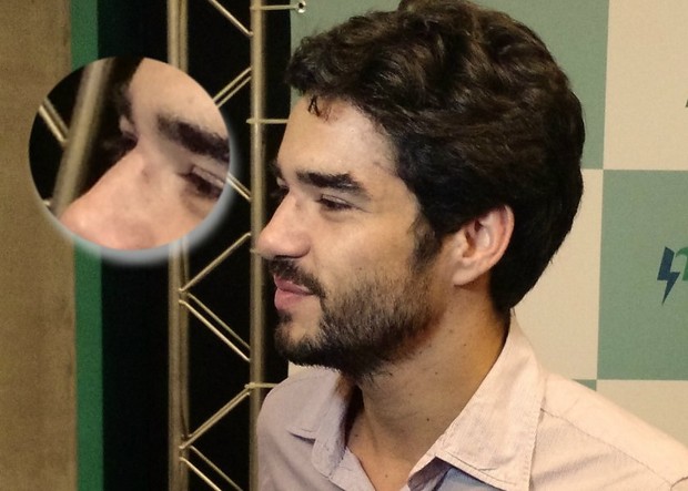 Caio Blat exibe ferimentos em sessão de cinema no Rio (Foto: Léo Martinez/EGO)