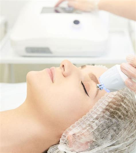 Microdermabrasion Facial: Benefits And How It Works