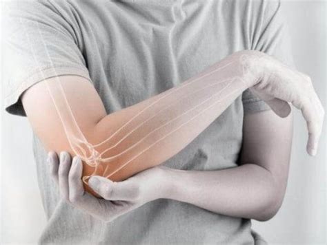 Elbow Olecranon Bursitis Symptoms - HealthBeauty123 | Your Health & Beauty Referrence