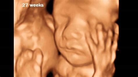 27 Weeks Pregnant - 3D Ultrasound Gallery - YouTube