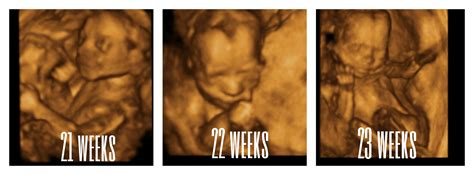 3D 4D- Ultrasound Pictures- Youngstown, Boardman Ohio