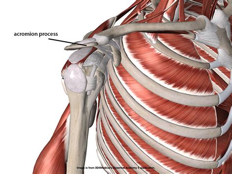 Types Of Acromion Shapes