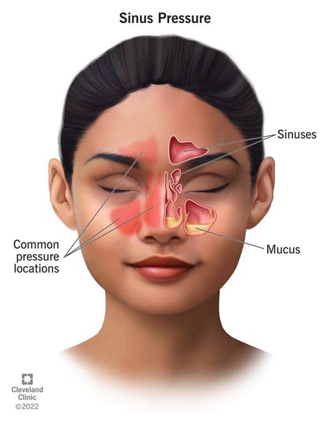 Sinus Pressure: Causes and How To Find Relief