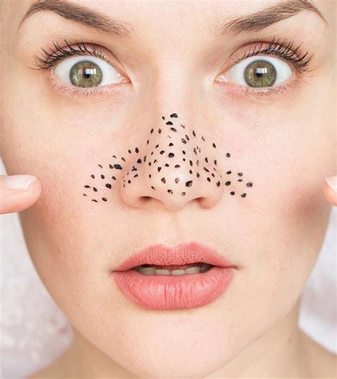 The Best Diy Blackhead Remover Mask - Home, Family, Style and Art Ideas