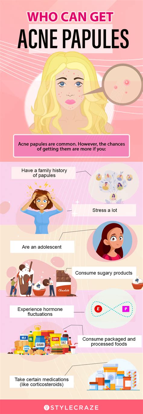 Acne Papules – Potential Causes & How To Get Rid Of Them