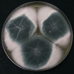 Aspergillus fumigatus - Allergy, Symptoms, & Treatment | Mold Busters