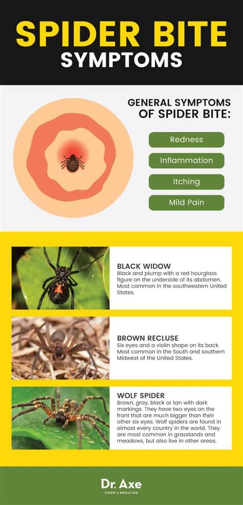 House Spider Bite Identification Chart