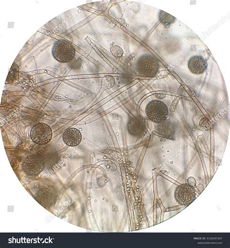 Rhizopus Spp Bread Mold Under Microscope Stock Photo 2110197167 | Shutterstock