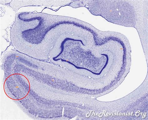 Exploring the Function of the Hippocampus by Anatomy - The Revisionist