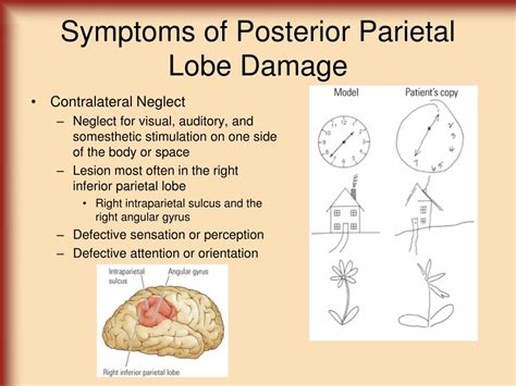 22+ Parietal Lobe Function Right Side PNG | Diagram Sheets