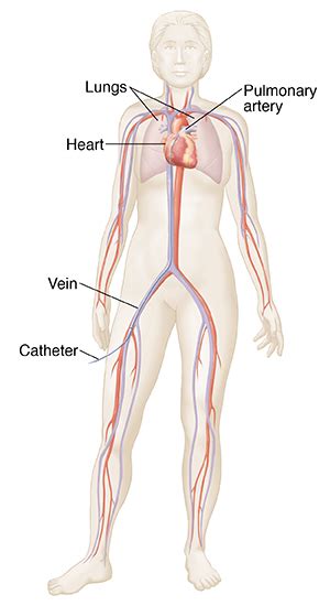 Pulmonary Angiography | Saint Luke's Health System