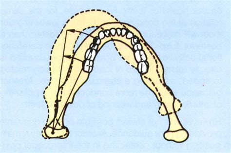 16 – Restoration of Anterior Teeth | Pocket Dentistry