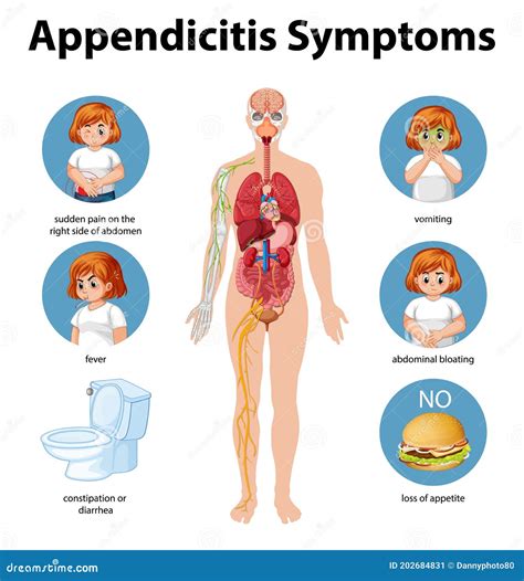 Appendicitis Signs Symptoms And Treatment - Learn Brainly