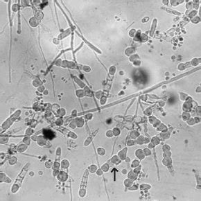 Cylindrical, 3 Á 7 celled macroconidia with the formation of... | Download Scientific Diagram