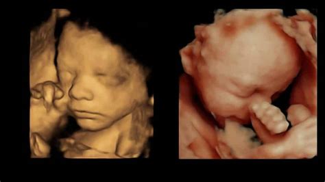 Our 3D/4D Scan Explained - Window to the Womb