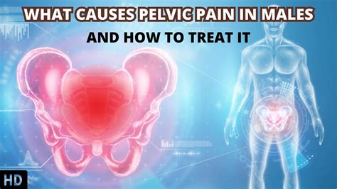 Chronic Pelvic Pain: Causes, Characteristics Treatment, 48% OFF