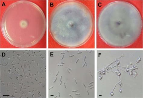 Morphological characteristics of Fusarium oxysporum. (A | Open-i