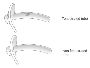 Fenestrated Vs Unfenestrated Tracheostomy | Tracheostomy Education