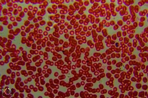 Under the Microscope: Red Blood Cells - Travis Hale (Photography and Science)