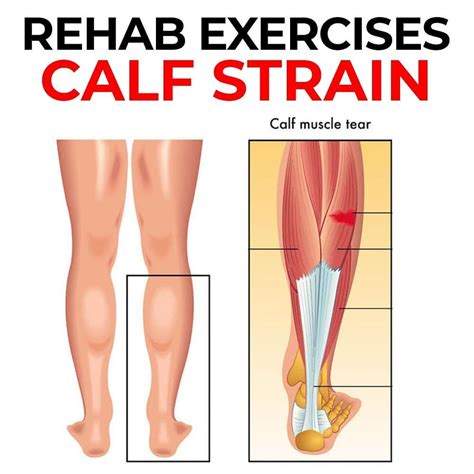 🚨 3 CALF STRAIN REHAB EXERCISES 🚨 The calf muscle consist of the gastrocnemius and soleus which ...