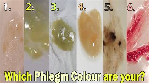 What Color Phlegm Means You're Getting Better - Marks Ruby