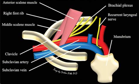 Subclavian Artery Netter